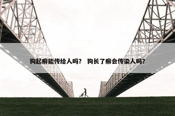 狗起癣能传给人吗？ 狗长了癣会传染人吗？